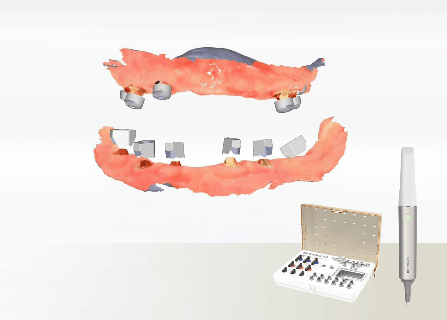 SHINING 3D Aoralscan Elite — Escáner intraoral con IPG