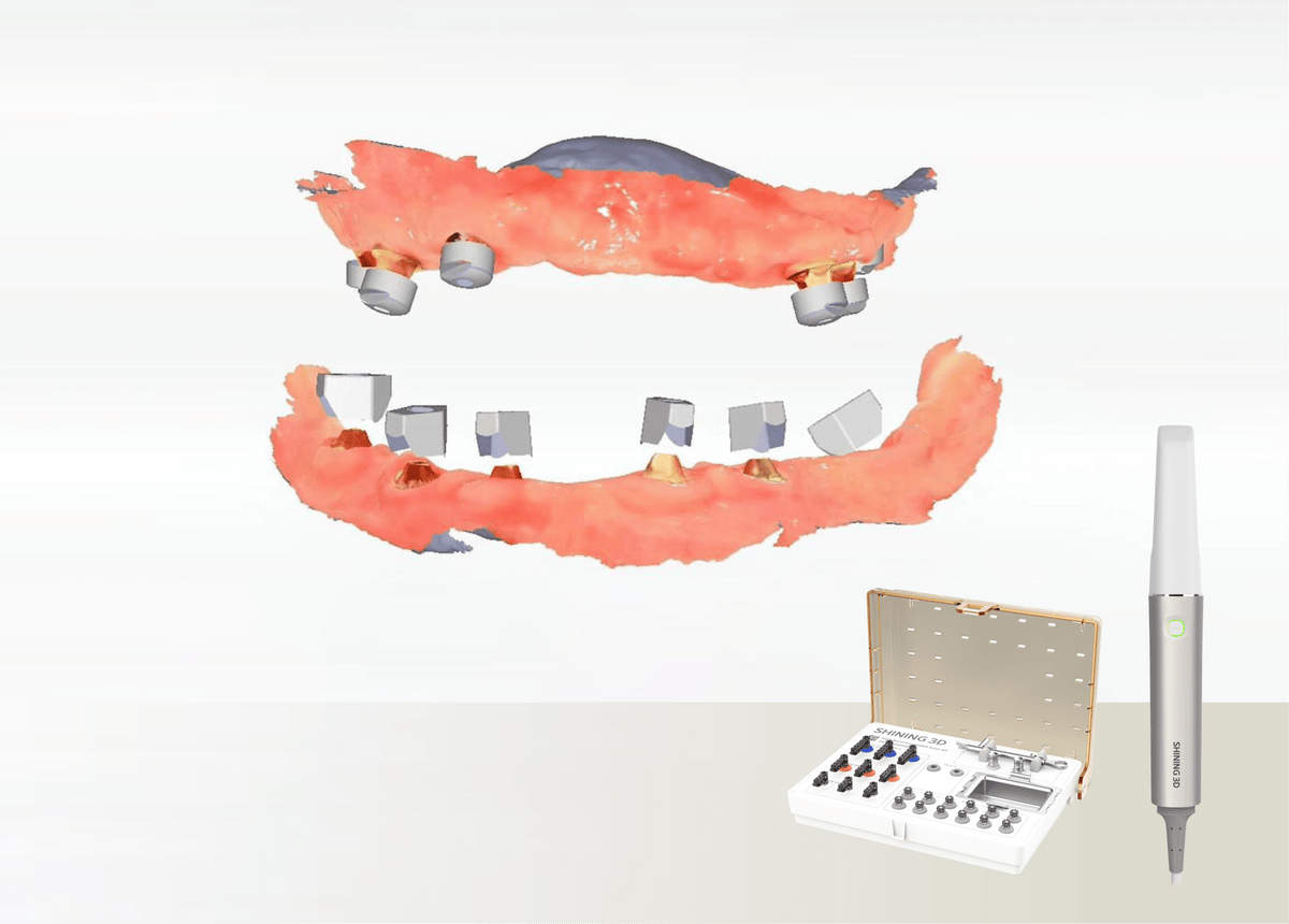 SHINING 3D Aoralscan Elite — Escáner intraoral con IPG