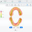 Aoralscan 3: comprobación digital de mordida