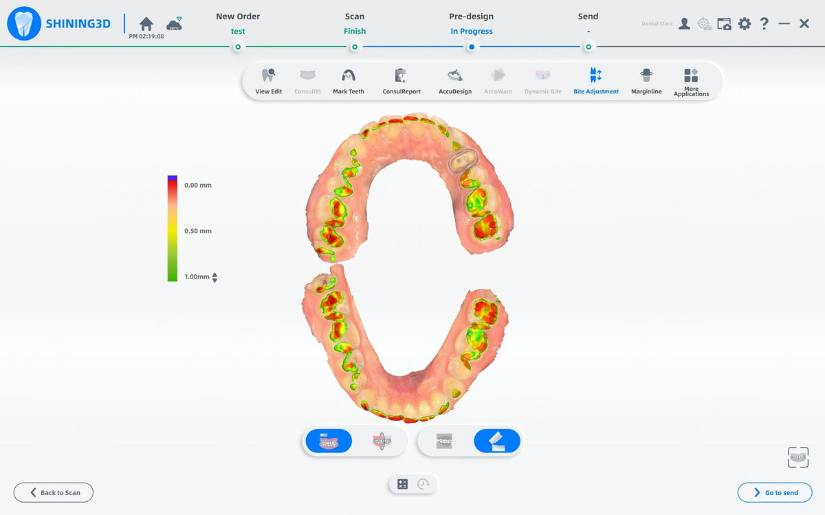 Aoralscan 3: comprobación digital de mordida