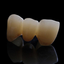 ZINTER Lumina - restauración dental multicapa de referencia