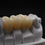 ZINTER Lumina - puente dental sobre modelo de laboratorio, resultado de referencia