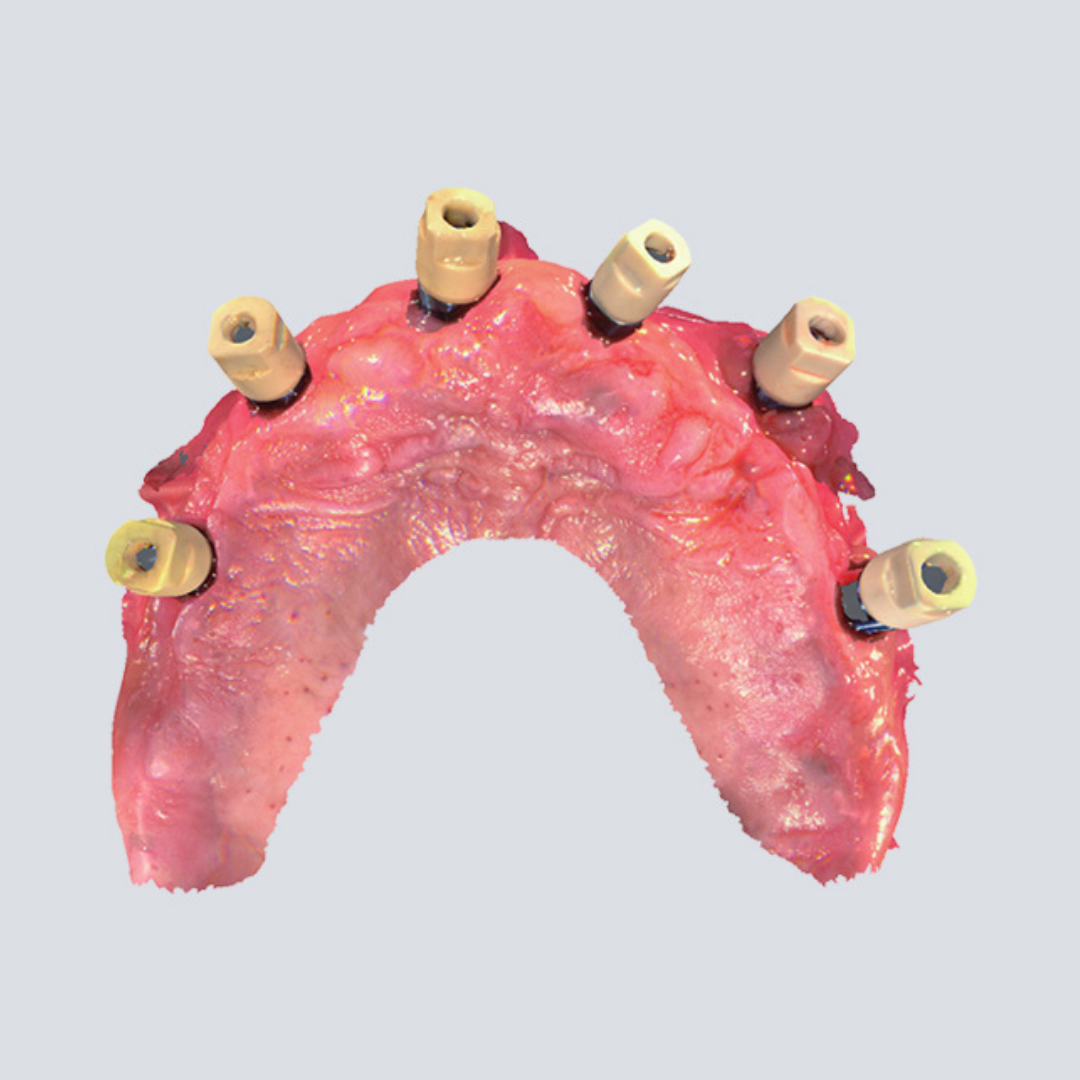 Digital Intraoral Scanner - SHINING 3D DENTAL