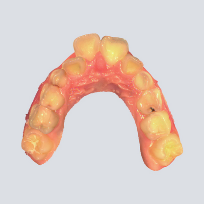 Digital Intraoral Scanner - SHINING 3D DENTAL