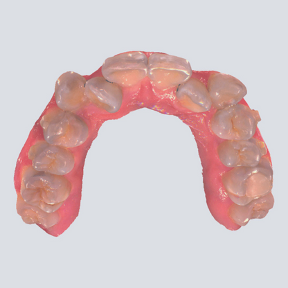 Digital Intraoral Scanner - SHINING 3D DENTAL