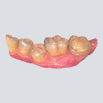 Digital Intraoral Scanner - SHINING 3D DENTAL