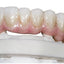 Biomic Stain/Glaze — Tintes y Glaseado para Cerámica Dental