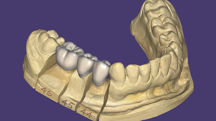 Soporte Técnico de Software Dental CAD/CAM - vista 3 | Liu Smile